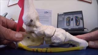 Optimal Performance Index System: Assessing Heel Pain