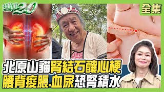 北原山貓腎結石釀心梗險送命！腰背痠脹.血尿恐腎積水！腎水腫退水這樣做！1功法強腎氣幫助逆轉腎！健康2.0 20250222【完整版】鄭凱云 洪永祥 洪峻澤 鄒瑋倫 梁惠雯 @tvbshealth20