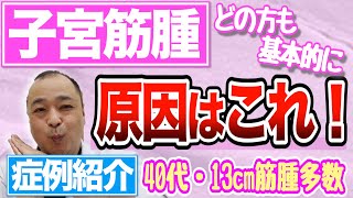 【症例紹介】どの方の子宮筋腫も原因は基本的に”これ”です！【原因と改善】