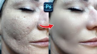 The fastest and Easy Way to Repair Skin in adobe  Photoshop