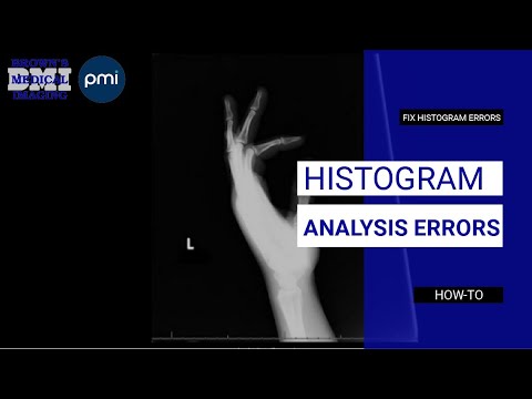 Understanding and Correcting Histogram Analysis Errors in Radiology