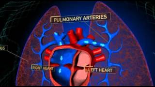 PHA - What is PH?