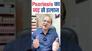 Psoriasis का जड़ से इलाज। Cure Psoriasis With Homeopathy | Best Treatment of Psoriasis