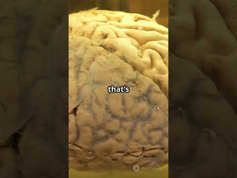 Mind Blowing Brain Fact  No Pain! #mind #mindfacts #rarefacts