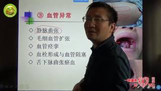 活血化瘀 1