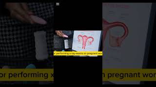 Week 5 to 12 of Pregnancy 🥰💯 #fetaldevelopment #weekbyweek #fetus #embryo