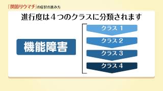 関節リウマチの症状の進み方
