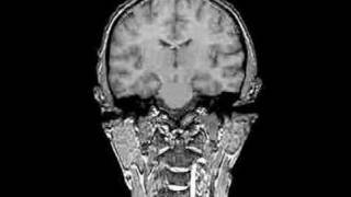 FMRI
