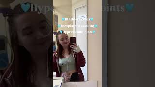 Missed signs I had Hypermobile Ehlers Danlos Syndrome #chronicillness #ehlersdanlossyndrome #shorts