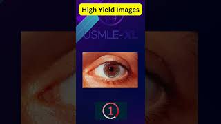 08 #usmlestep1 #medical #firstaid #highyield