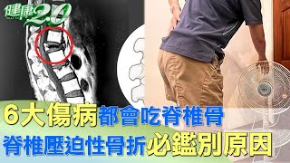 6大傷病都會吃脊椎骨 脊椎壓迫性骨折必鑑別原因 健康2.0@tvbshealth20