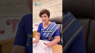 Which Is Better for IVF Success — Day 3 or Day 5 Embryo Transfer? | Dr Supriya #drsupriya #shorts