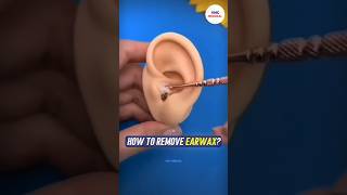 How to remove earwax by VMC Medical