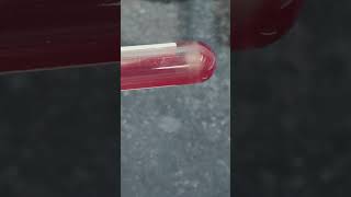 Low HB patent blood sample 🩸#laboratory #labtechnician #hematologyanalyzer #medicallab #clinicallab