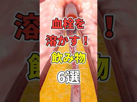 血栓をどばどば溶かす魔法の飲み物６選！　#医療 #健康   #病気 #予防医療  #予防 #雑学 #長寿命　#shorts