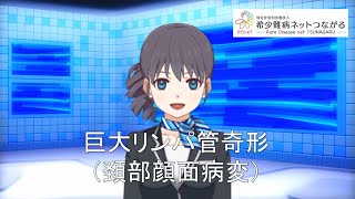 巨大リンパ管奇形（頚部顔面病変）　【指定難病278】難病（予備群）当事者香取の難病紹介
