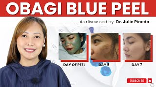 OBAGI BLUE PEEL TREATMENT