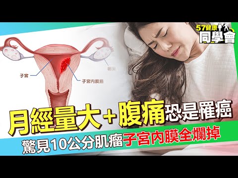 30歲女「月經量大+腹痛」恐是罹癌！？超音波驚見10公分肌瘤「子宮內膜全爛掉」醫師嘆：子宮沒保住！【 @57healthy  】#陳榮堅 醫師