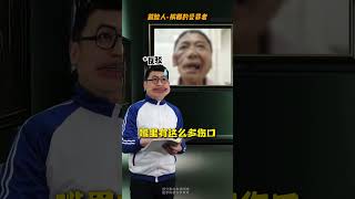 警惕吃出来的癌！ #抖出健康知识宝藏 #口腔癌 #槟榔 #医学科普