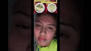 Goree cream | Goree whitening cream | pigmentation cream | dark spots remove cream |#shortvideo