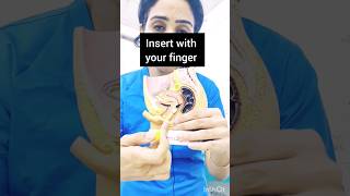 How to Insert Vaginal Tablet 💊🤷#shorts #vagina #pessary