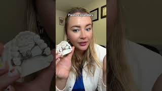 Why we use palate expanders :) #palateexpander #expander #braces #crossbite