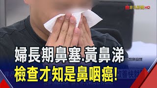 鼻塞.黃鼻涕倒流吃藥未改善 竟是鼻咽癌作祟! 癌細胞擴散侵襲神經 眼.耳.鼻症狀各不相同｜非凡財經新聞｜20250326