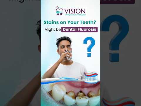 Are you noticing unusual stains or spots on your teeth? 😬 #visiondental
