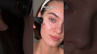 No more acne scars with this 😻🫣#banish #acne #skincare #acnescars #acnetips #oilyskin #skintips