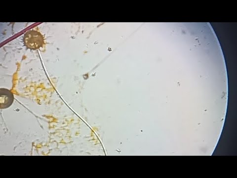 Pollen Germination On Slide Using Nutrient Solution