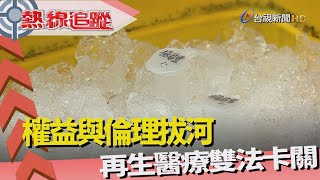 熱線追蹤-細胞治療 屬支持性療法