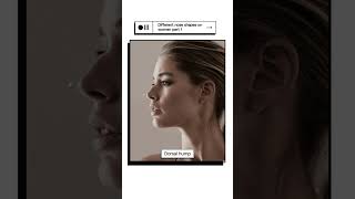 How Nose Shapes Impact Side Profile on Women