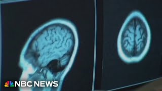 How to tell if you have a concussion