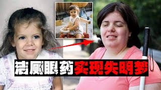 【截肢癖】疯狂向往残疾，健全让他们很不舒服【郑郑得证】