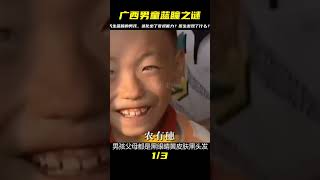 廣西十歲男童天生藍瞳，進化出夜視能力，醫生發現事情并不簡單 #古董 #開棺 #古墓 #考古發現 #考古
