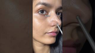 Blackheads Solution✅ #skincare #youtubeshorts #viralvideo #hairstyle #shorts #makeup #diy #haircare