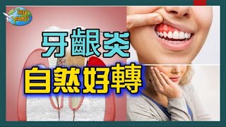 【牙 齦 發炎】旅行突發牙齦痛？中醫＋護齒法讓你緩解牙齦 發炎！| 降低 牙齦萎縮風險！|牙齒養護 全攻略 |牙齦炎怎麼治？