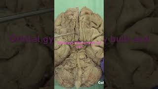 Orbital area of cortex, olfactory bulbs, tracts #anatomy #neuroanatomy #brain #brainanatomy#cortex