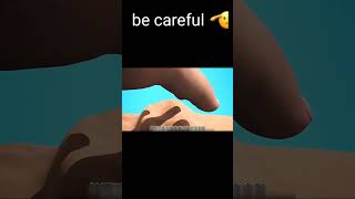 be careful #safeliving #viral #staysafe #alertnessmatters #safetytips