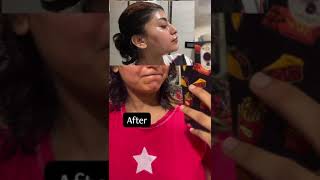 Vitamin C for Face | Before & After