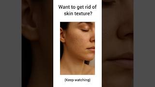 you got textured skin?🤔#mandelicacid#texturedskin#skinsolution#skincare#foryou#boostviews#viralshort