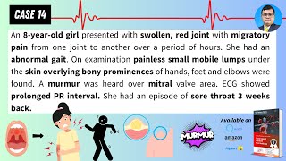 Case based Medical Microbiology Tutorials:Case 14: Arthritis, Murmur, gait problem after sore throat