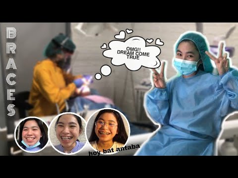 Braces | DRIMKAMTRU | M.A.L Dental Clinic | TIN MIRANDILLA