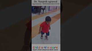 Clubfoot baby walking like normal child #clubfoottreatment #ctev #clubfoot #clubfootjourney #ponseti