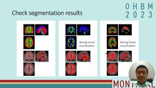 Quality control for resting-state and task fMRI in SPM