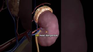 the most dangerous signs of kidney failure #health #healthtips #diabetic #loseweight #detoxdrink