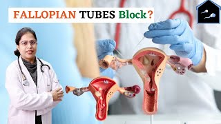 FALLOPIAN TUBES BLOCK? :- in English By Dr. Sakshi Bansal