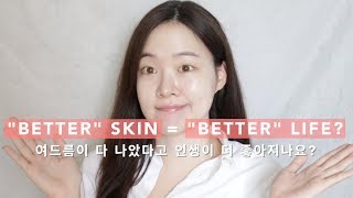 No More Acne=Better Life? | #AcneTalk