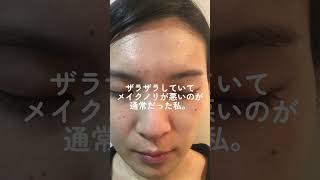 肌質改善をしてニキビがなくなった36歳エステティシャン　#肌質改善　#ニキビ　#ハーブピーリング　#revi