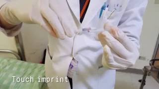 骨髓穿刺影片